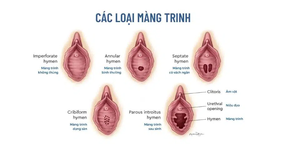 Lần đầu quan hệ có đau không? Chuẩn bị gì cho cuộc yêu thăng hoa | Thăng Hoa Tình